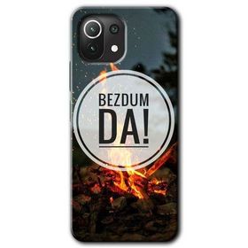 Gramaphone Xiaomi Mi 11 Lite Kılıf HD Desen Baskılı Arka Kapak - Bezdum Da Kılıf