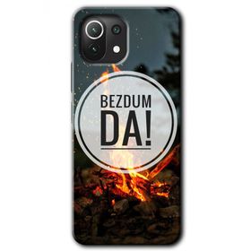 Gramaphone Xiaomi Mi 11 Lite Kılıf HD Desen Baskılı Arka Kapak - Bezdum Da Kılıf