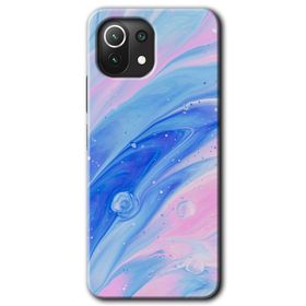Gramaphone Xiaomi Mi 11 Lite Kılıf HD Desen Baskılı Arka Kapak - Blur Lights Kılıf