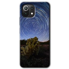 Gramaphone Xiaomi Mi 11 Lite Kılıf HD Desen Baskılı Arka Kapak - Blur Lights Kılıf