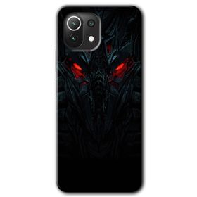 Gramaphone Xiaomi Mi 11 Lite Kılıf HD Desen Baskılı Arka Kapak - Blur Lights Kılıf