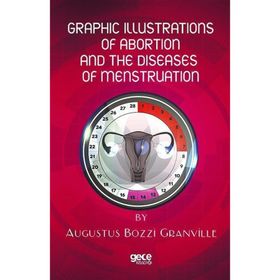 Graphic Illustrations Of Abortion And The Diseases Of Menstruation Augustus Bozzi Granville-Gece Kitaplığı