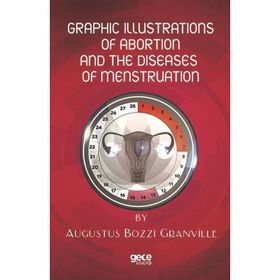 Graphic Illustrations Of Abortion And The Diseases Of Menstruation Augustus Bozzi Granville-Gece Kitaplığı
