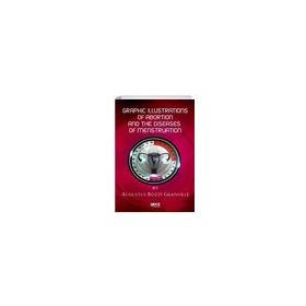 Graphic Illustrations Of Abortion And The Diseases Of Menstruation Augustus Bozzi Granville-Gece Kitaplığı