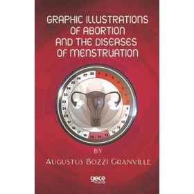 Graphic Illustrations Of Abortion And The Diseases Of Menstruation Augustus Bozzi Granville-Gece Kitaplığı