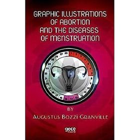 Graphic Illustrations Of Abortion And The Diseases Of Menstruation Augustus Bozzi Granville-Gece Kitaplığı