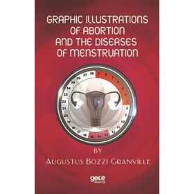 Graphic Illustrations Of Abortion And The Diseases Of Menstruation Augustus Bozzi Granville-Gece Kitaplığı