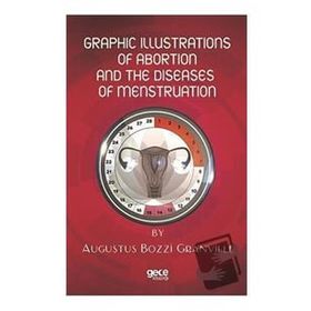 Graphic Illustrations Of Abortion And The Diseases Of Menstruation Augustus Bozzi Granville-Gece Kitaplığı
