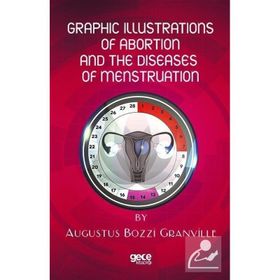 Graphic Illustrations Of Abortion And The Diseases Of Menstruation Augustus Bozzi Granville-Gece Kitaplığı