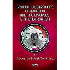 Graphic Illustrations Of Abortion And The Diseases Of Menstruation Augustus Bozzi Granville-Gece Kitaplığı