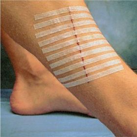 Hartmann Omnistrip Steril Strip 6x101 mm 10 Adet Dikiş Bantı