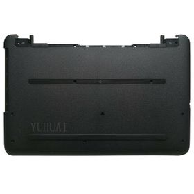 Hp 15-BA008NT Siyah Üst Kasa