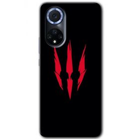 Huawei Nova 9 Ayı Pençesi Baskılı Uyumlu Silikon Kılıf