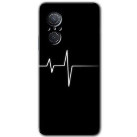 Huawei Nova 9 SE Flash Logo Baskılı Uyumlu Silikon Kılıf