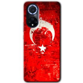 Huawei Nova 9 Siyah Mermer Desenli Y Harfi Baskılı Uyumlu Silikon Kılıf