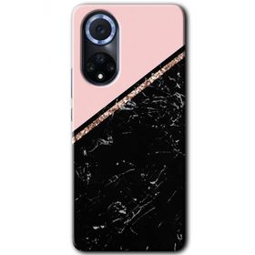 Huawei Nova 9 Yarım Mermer Baskılı Uyumlu Silikon Kılıf
