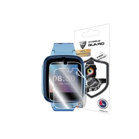 Ipg General Mobile GM Buddy Akıllı Çocuk Saati Uyumlu 2 Adet Hydrogel Ekran Koruyucu