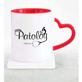 Kişiye Özel Patolog Kupa Bardak