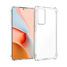 KNY Xiaomi Mi 12T Ultra Korumalı Şeffaf Antishock Silikon Cep Telefonu Kılıfı