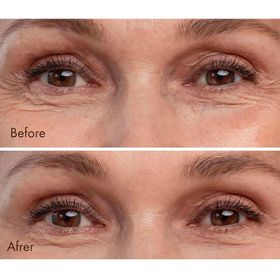 Maruderm 30 ml Ginseng Cilt Yenileyici Serum