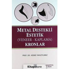 METAL DESTEKLI ESTETIK (VENEER - KAPLAMA) KRONLAR - HÜSNÜ YAVUZYILMAZ