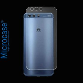 Microcase Huawei P10 Full Arka Kaplama TPU Soft Koruma Film