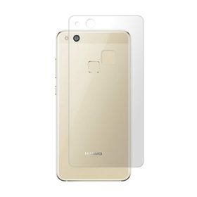 Microcase Huawei P10 Lite Full Arka Kaplama TPU Soft Koruma Film