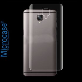 Microcase OnePlus 3 Full Arka Kaplama TPU Soft Koruma Film