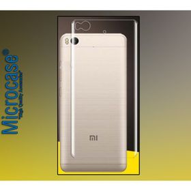 Microcase Xiaomi Mi 5S Full Arka Kaplama TPU Soft Koruma Film