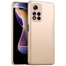 Microsonic Matte Silicone Xiaomi Redmi Note 11 Pro Plus Cep Telefonu Kılıfı