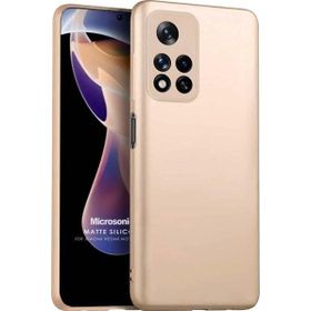 Microsonic Matte Silicone Xiaomi Redmi Note 11 Pro Plus Gold Cep Telefonu Kılıfı
