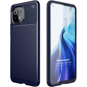 Microsonic Xiaomi Mi 11 Lite Legion Series Lacivert Kılıf