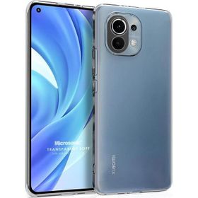 Microsonic Xiaomi Mi 11 Lite Transparent Soft Beyaz Kılıf
