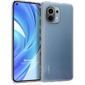 Microsonic Xiaomi Mi 11 Lite Transparent Soft Beyaz Kılıf