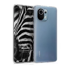 Microsonic Xiaomi Mi 11 Transparent Soft Beyaz Kılıf
