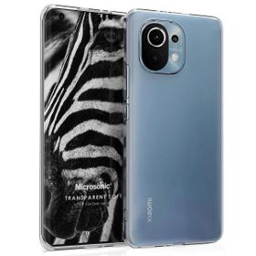 Microsonic Xiaomi Mi 11 Transparent Soft Beyaz Kılıf