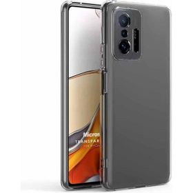 Microsonic Xiaomi Mi 11T Pro Transparent Soft Beyaz Kılıf