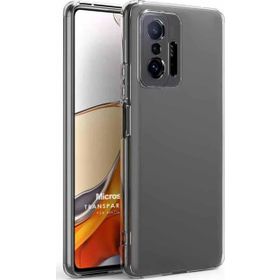 Microsonic Xiaomi Mi 11T Transparent Soft Beyaz Kılıf
