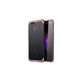 Microsonic Xiaomi Mi 5X Skyfall Transparent Clear Rose Gold Kılıf