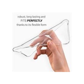 Microsonic Xiaomi Mi A1 Transparent Soft Beyaz Kılıf