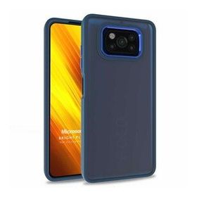 Microsonic Xiaomi Poco X3 NFC Bright Planet Lacivert Cep Telefonu Kılıfı