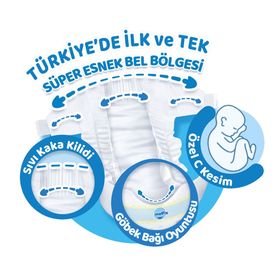 Molfix No:1 Yenidoğan 44 Adet Bebek Bezi