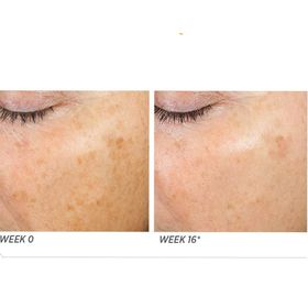 Neostrata Enlighten Illuminating 30 ML Leke Giderici Serum