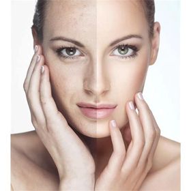 Neutrogena Visibly Clear Pore Shine 150 ml Peeling Yüz Temizleme Jeli