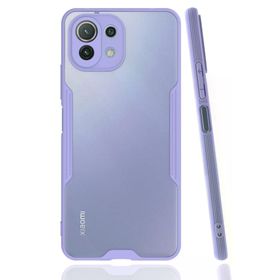 Newface Lila Platin Silikon Xiaomi Mi 11 Lite Kılıf