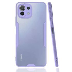 Newface Lila Platin Silikon Xiaomi Mi 11 Lite Kılıf