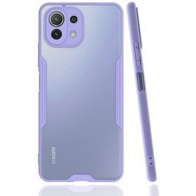 Newface Lila Platin Silikon Xiaomi Mi 11 Lite Kılıf