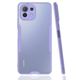 Newface Lila Platin Silikon Xiaomi Mi 11 Lite Kılıf