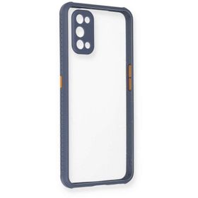 Newface Realme 7 Pro Miami Şeffaf Silikon Gri Cep Telefonu Kılıfı