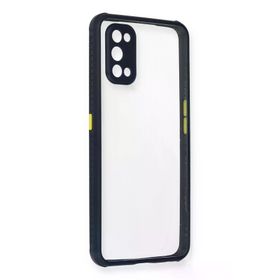 Newface Realme 7 Pro Miami Şeffaf Silikon Lacivert Cep Telefonu Kılıfı